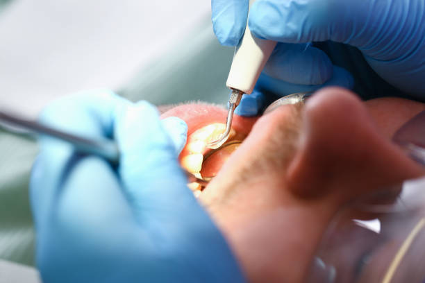 Best Pediatric Emergency Dentist in Salmon Creek, WA