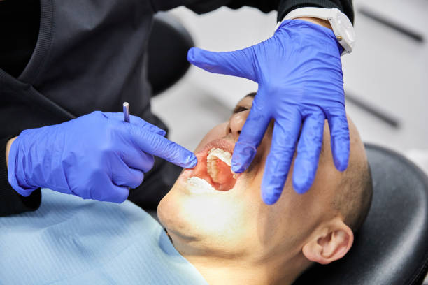 Best Emergency Root Canal Treatment in Salmon Creek, WA