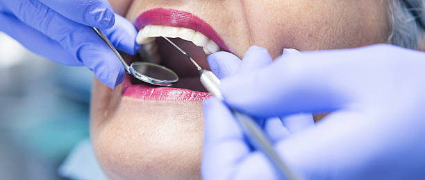 Best Urgent Care for Lost Fillings or Crowns in Salmon Creek, WA